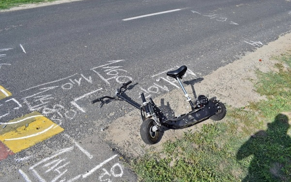 Kórházba került az elektromos rollerrel balesetet szenvedett gyerek