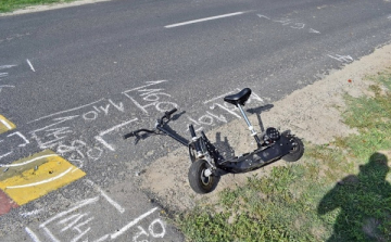 Kórházba került az elektromos rollerrel balesetet szenvedett gyerek